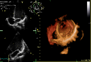 Heart valves via wikipedia