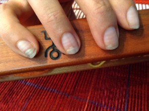 Lines on my nails measure out treatment cycles.