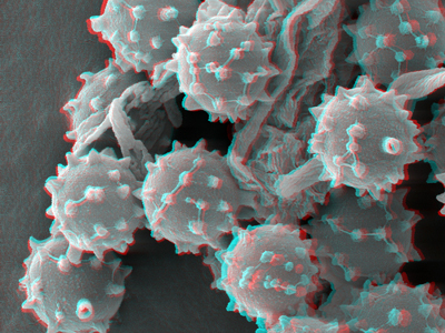 Mold is ubiquitous in the Northwest. Our house on the north side of a hill has more than its share.